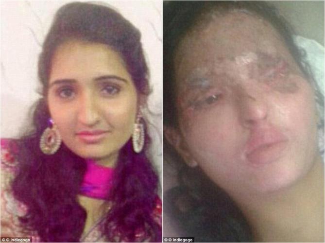 毁容独眼少女t台秀 脸毁了还有灵魂