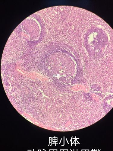 组胚垂体脾肾切片