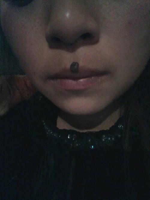 痣长在鼻子和嘴巴中间有什么好处?