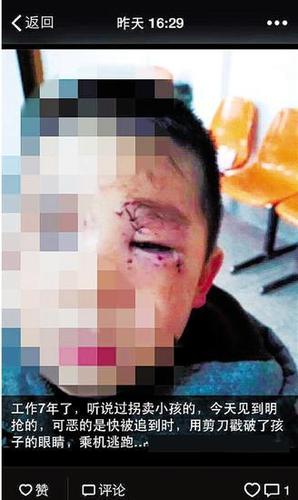 抢孩子未遂戳其眼 乱戳孩子眼睛或失明