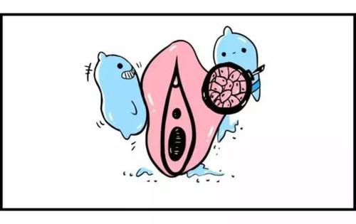 女生患有外阴炎有什么症状?会不会传染?