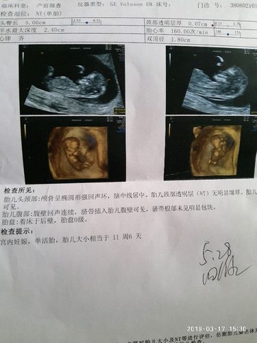 11周的宝宝b超单子帮我看看