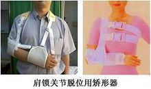 适用于肩锁关节脱位整复后的固定.