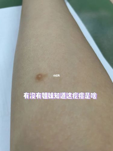 胳膊上长了个硬硬的疙瘩_医疗健康_医疗健康其他