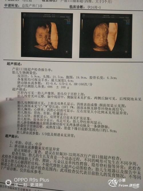 孕24周 6天,宝宝估重750g啦!