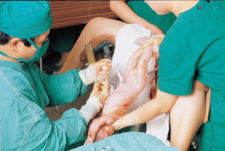 图解自然分娩全过程,胆小者勿入!