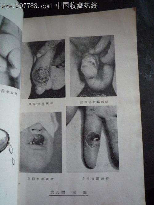 花柳病学,叶维法著,文通书局印行