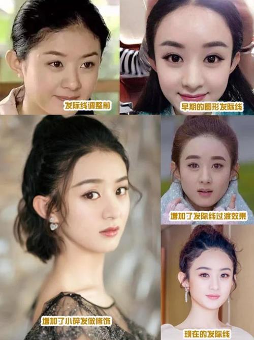 女生发际线高适合什么刘海最合适的4种发型