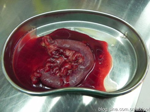 切除的子宫及卵巢以及伤口,术后伤口贴上创可贴即可.