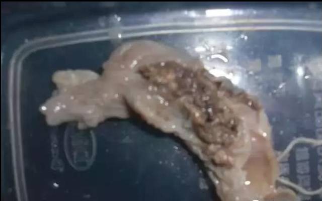 子宫不"洗澡"您永远不知道这么脏. - ddf545545155的主页