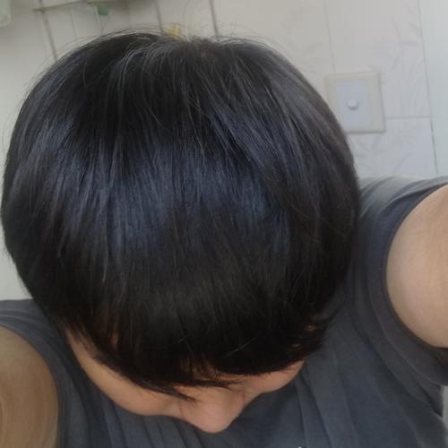 我头发很贴头皮,麻烦帮我看下是头发太少还是头发太软