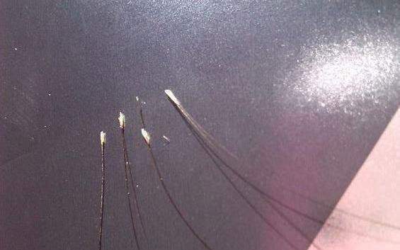 将头发拔掉,力量完全作用在毛囊,非常容易造成毛囊撕裂和毛囊拔脱