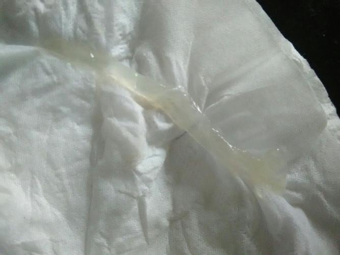 傻傻分不清楚,这到底是白带还是什么东西啊?