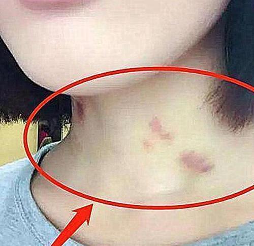 原创14岁女儿脖子上出现"草莓",父母逼问实情,女儿的回答引深思