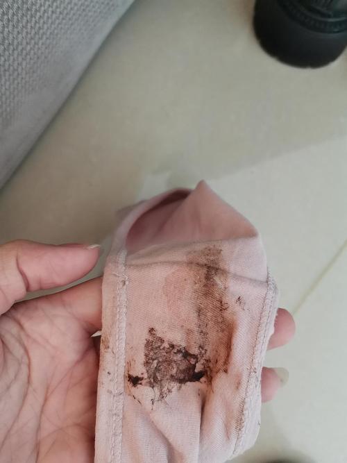 慌的不行!xsh几次后,内裤上有褐色分泌物.