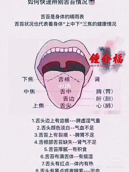你是否是亚健康,伸出舌头看看自己_医疗健康_医疗健康