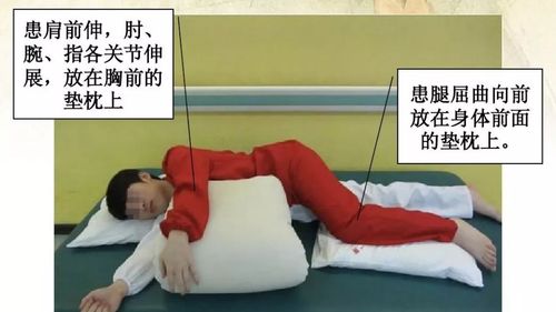 良肢位 健侧卧位