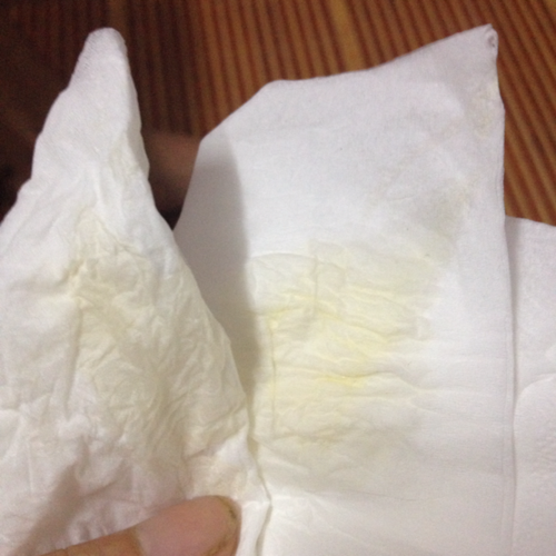 怀孕11周,突然有黄色像水一样的液体流出来