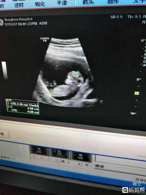 11周胎心167是女孩吗