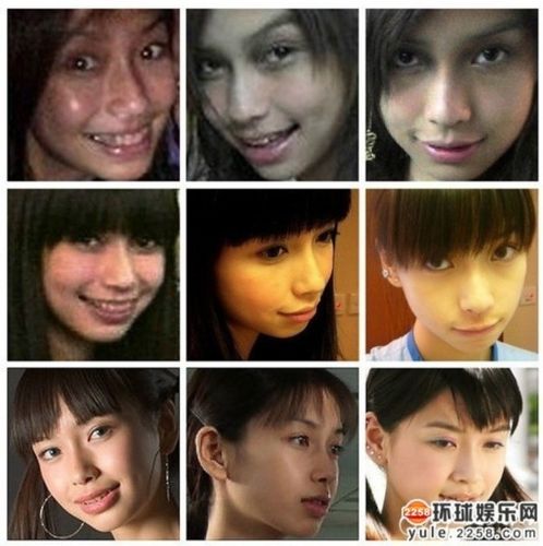 angelababy整容前后汇总