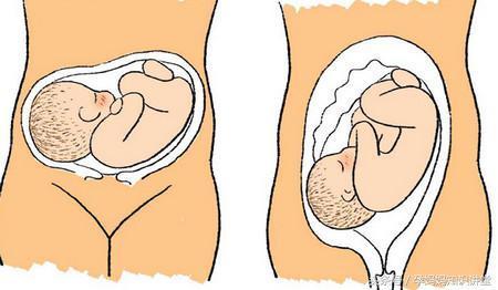 孕8月胎儿外形是怎样的,也该确定胎位是否正常了