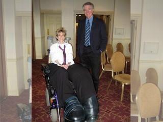 英国女子患罕见巨腿症两(组图)