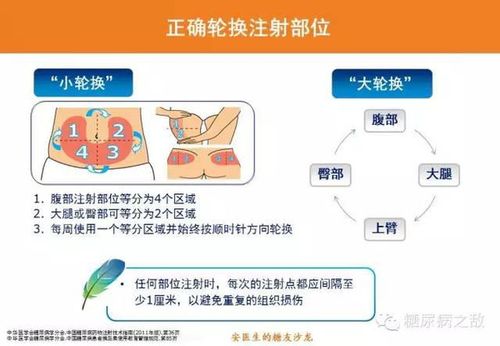 九个步骤掌握胰岛素的正确注射方法