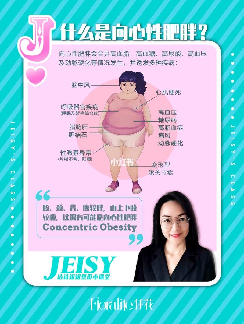 什么是向心性肥胖?_有氧运动_高脂肪_瘦身_增高_代谢