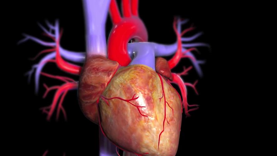 心脏治疗心脏手术3d三维动画