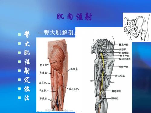 肌肉注射-ppt(精)