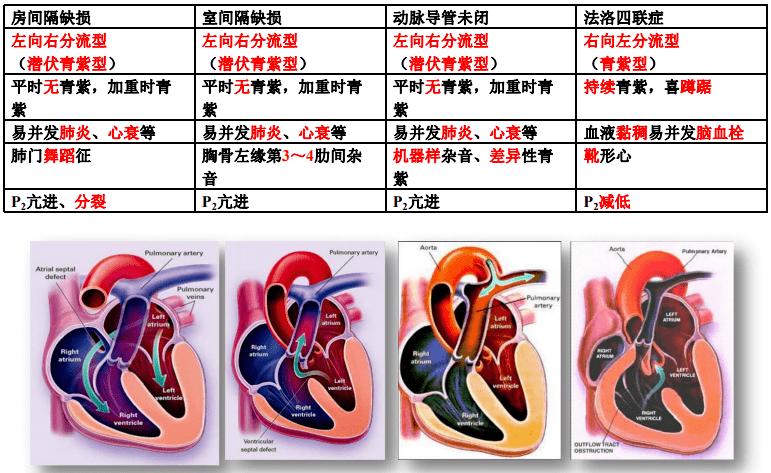 (最重要,对 青紫 程度起决定作用), 室间隔缺损 , 主动脉骑跨