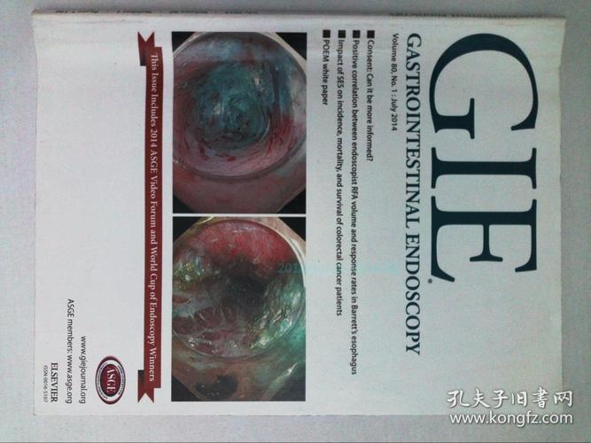 gastrointestinal endoscopy gie消化道胃肠内镜检查医学2014/07