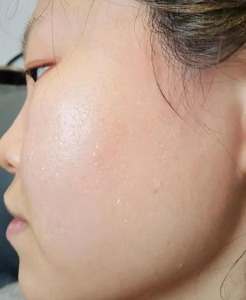 先自查这几个原因,好皮肤自然会