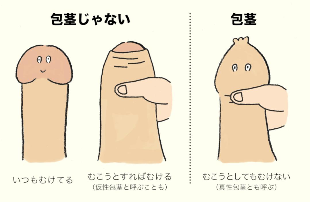 男孩包茎正确清洗可以减少花冤枉钱