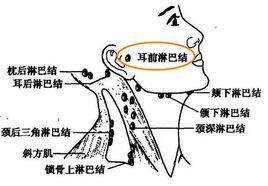 耳前淋巴结