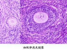 生长卵泡显微图