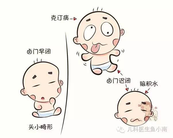 早闭就有可能头小畸形,迟闭就要看看是不是佝偻病,脑积水,克汀病