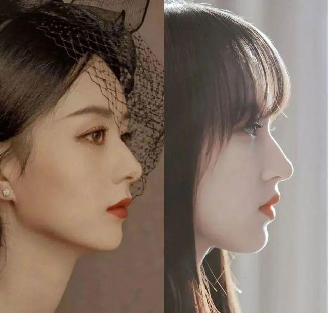 颧骨下颌收得好,侧面立体深邃,搭配折角明显的鼻额角,会让鼻子显得更