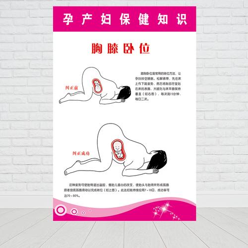 医院卫生制度文化妇产科胸膝卧位挂图走廊墙贴孕妇保健宣传画海报产科