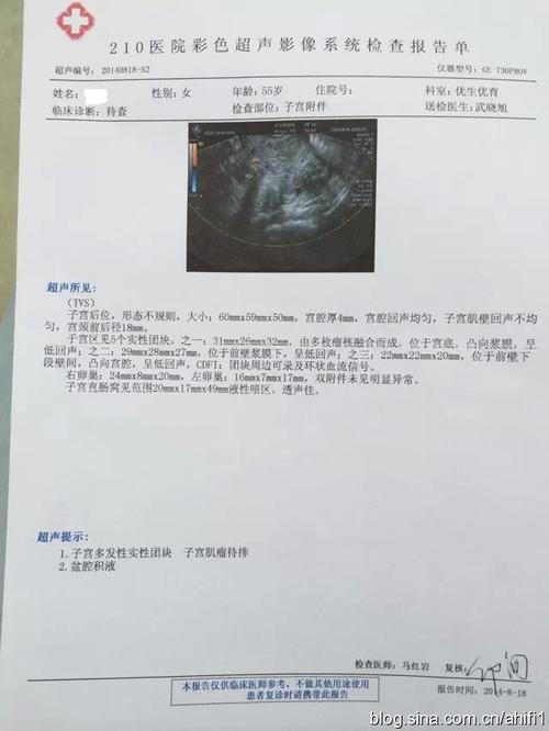 2014年治疗一例肝血管瘤