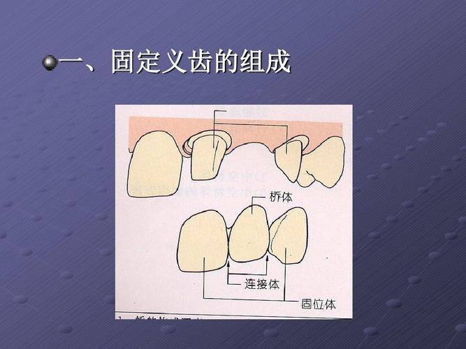 固定义齿组成ppt