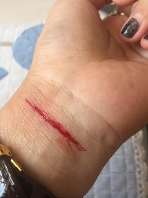 求把伤口p的稍微严重一点,跪求