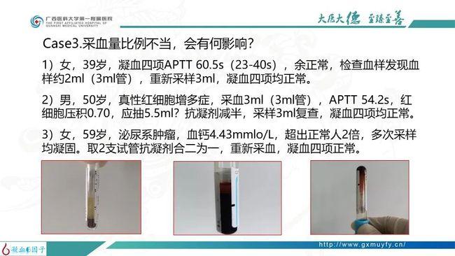 出凝血质量控制-静脉血液标本采集注意事项 | 课件分享