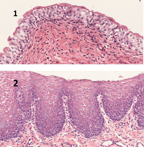 1,膀胱的上皮是变移上皮,属于复层上皮,仔细观察图中结构,区分图1和