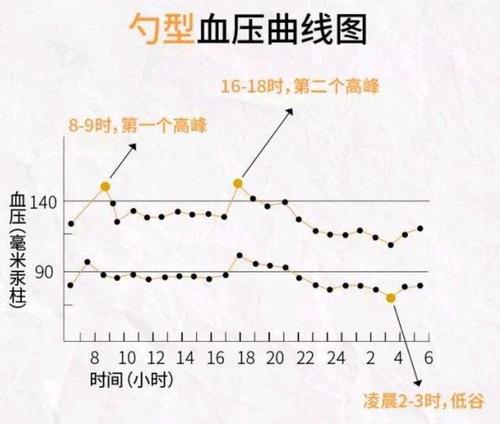 24小时血压波动图