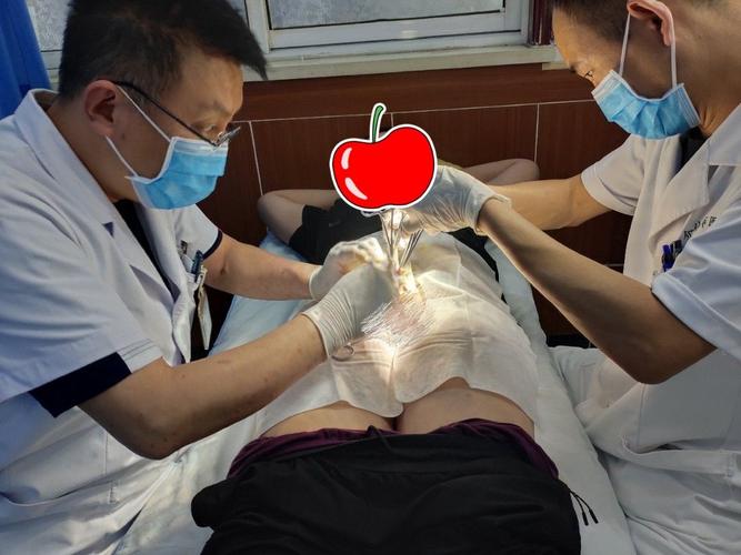 其它 包皮环切术---术前准备 写美篇     又是一年的学生包皮手术高峰