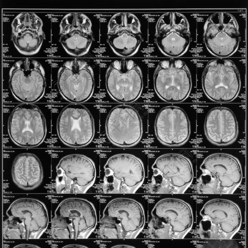 头部磁共振图像