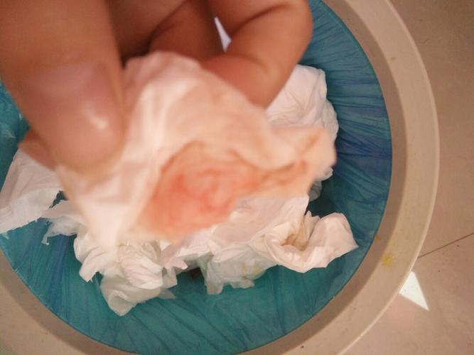 今天和老公***,结果之后下面流了一点水和见了一点红