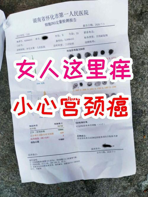 09女人身体这里痒,八成是宫颈癌,要小心_宫颈癌_hpv