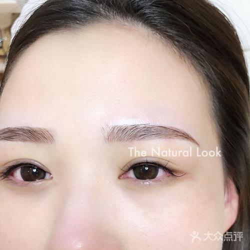 不结痂丝绒眉案例